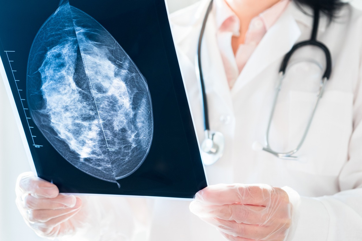 Consultant breast surgeon reviewing a mammogram for a Kensington patient